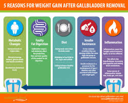 5 Reasons For Weight Gain After Gallbladder Removal