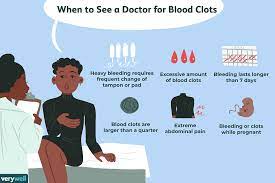 period blood clots cause for concern