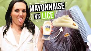 removing lice with mayonnaise watch