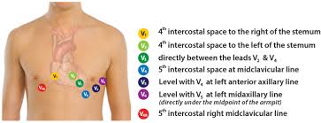 12 Lead Ecg Placement Aed Superstore Resource Center