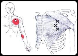 trigger point therapy specialized