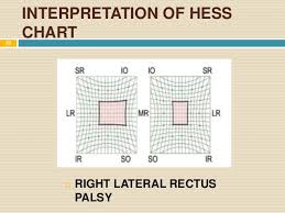 Hess Chart