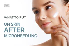 what to put on skin after microneedling