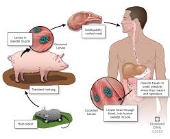 They may include the following Trichinosis Food Poisoning Symptoms Causes Treatment