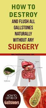 How To Destroy And Flush All Gallstones Naturally Without