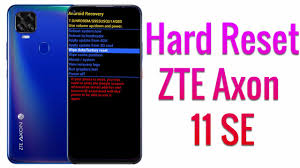 You will need to know then when you get a new router, or when you reset your router. Hard Reset Zte Axon 11 Se Factory Reset Remove Pattern Lock Password How To Guide The Upgrade Guide