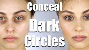 how to conceal dark circles under eyes