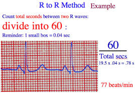 heart rate method