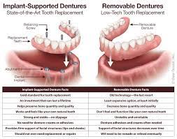 fixed dentures family dental