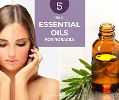 5 best essential oils for rosacea plus