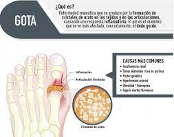 gota qué es causas síntomas