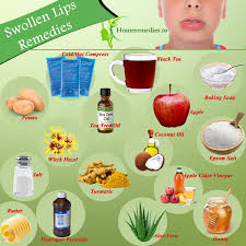 Swelling of the lips often occurs due to a form of physical trauma to the soft tissues of the lips. Reduce Lip Swelling Fast With These Home Remedies Natural Ways To Get Rid Of Swollen Lips Tips To Treat Upper And L Swollen Lips Remedies Cold Sores Remedies
