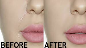 Cara menghilangkan bibir hitam dan kering secara alami berikutnya adalah dengan menggunakan kunyit. 4 Bahan Alami Dapat Menghilangkan Kerutan Di Sekitar Mulut Tribun Manado