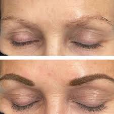 are your brows in need of an uplift