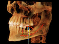 cone beam computed tomography cbct