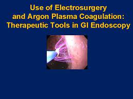 argon plasma coagulation theutic