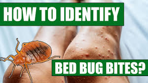how to identify bed bug bites can