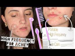 project e beauty argon high frequency