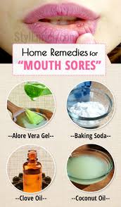 home remes for mouth sores or canker