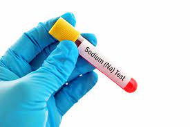 low or high sodium blood test causes