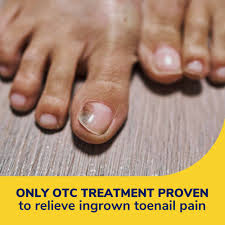 ingrown toenail treatment pain relief