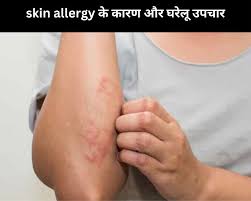 skin allergy 4 causes and 5 home