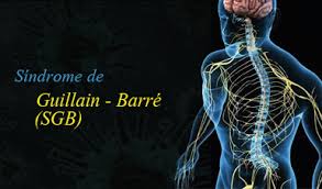 Attack their peripheral nerves resulting in partial loss of sensation loss of Vigilancia Prevencion Y Control Del Sindrome De Guillain Barre Cdc Minsa