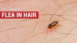 Keep finding little black bugs appearing to hop however they also fly, we don't have any bites they are tiny black little dots with wings. Bed Bugs In Hair Symptoms Pictures And Treatment For Bugs In Hair