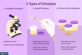 urinalysis uses side effects