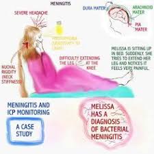 Case Study Meningitis   Meningitis   Stroke