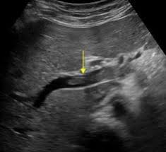 Vascular Ultrasound Case Studies Online Course