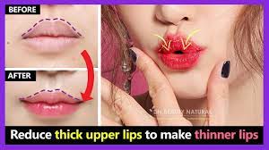 fat upper lips to make thinner lips