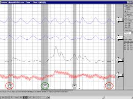 Federal Polygraph School Gave Countermeasure Information To