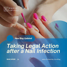 legal action after a nail infection