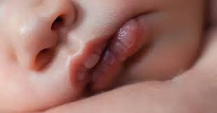 es lips white after tfeeding