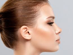 dorsal hump causes of nose ps