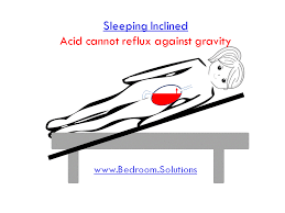 adjustable beds for acid reflux