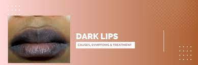 dark lips types causes symptoms