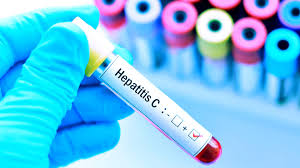 Resultat d'imatges de hepatitis c