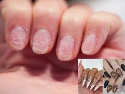 repair damaged nails after getting gel