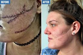 Ajonte — glasgow smile 03:15. Scots Mum Who Needed 80 Stitches After Savage Attack On Face By Strangers Robbed Of Ability To Smile