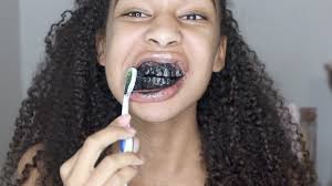 What are some effective ways to whiten teeth with braces still attached? Beware Whitening Promise Of Charcoal Toothpastes The Family Dental Center