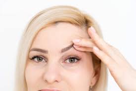 can botox cause droopy eyelids u s