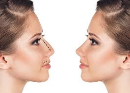 Learn what a deviated septum look like. Deviated Septum Surgery Cost Average Cost Insurance More Deviated Septum Surgery