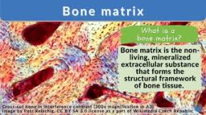 bone matrix definition and exles