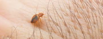 How Do Bed Bugs Bite Rus S Pest
