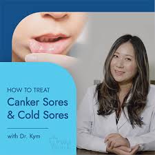 cold sores canker sores and how to