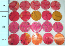 After 24 hours growth on xld agar. Salmonella Are Shown As Whitish Pink Colonies With Black Centres On Download Scientific Diagram