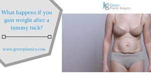 gain weight after a tummy tuck