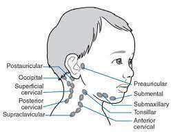 swollen lymph nodes in the neck dr